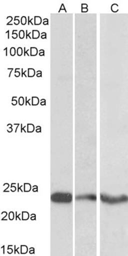 46-513 (0.3ug/ml) staining of Human Cerebellum (A) Frontal Cortex (B) and Hippocampus (C) lysates (35ug protein in RIPA buffer). Primary incubation was 1 hour. Detected by chemiluminescence.