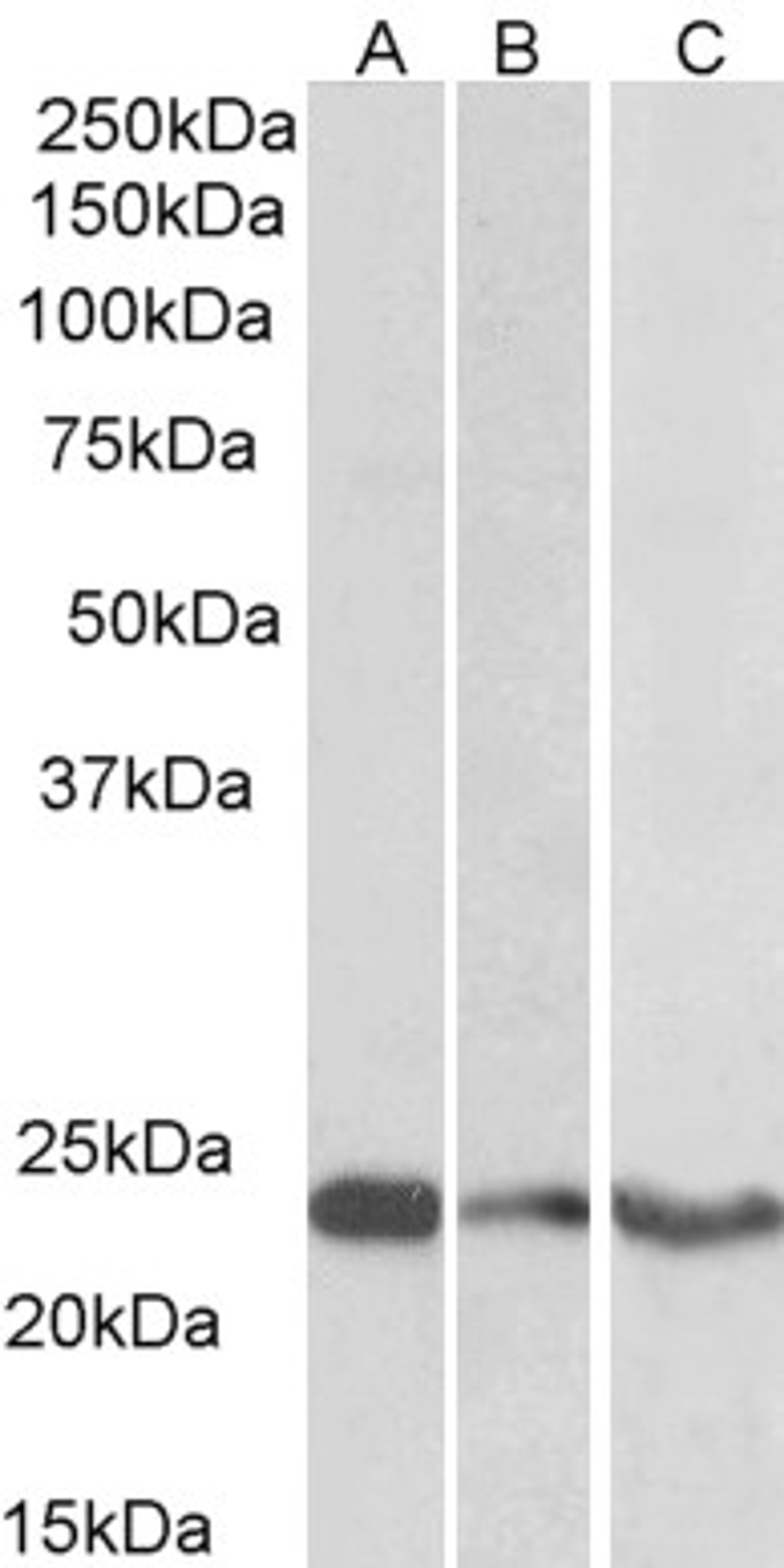 46-513 (0.3ug/ml) staining of Human Cerebellum (A) Frontal Cortex (B) and Hippocampus (C) lysates (35ug protein in RIPA buffer). Primary incubation was 1 hour. Detected by chemiluminescence.