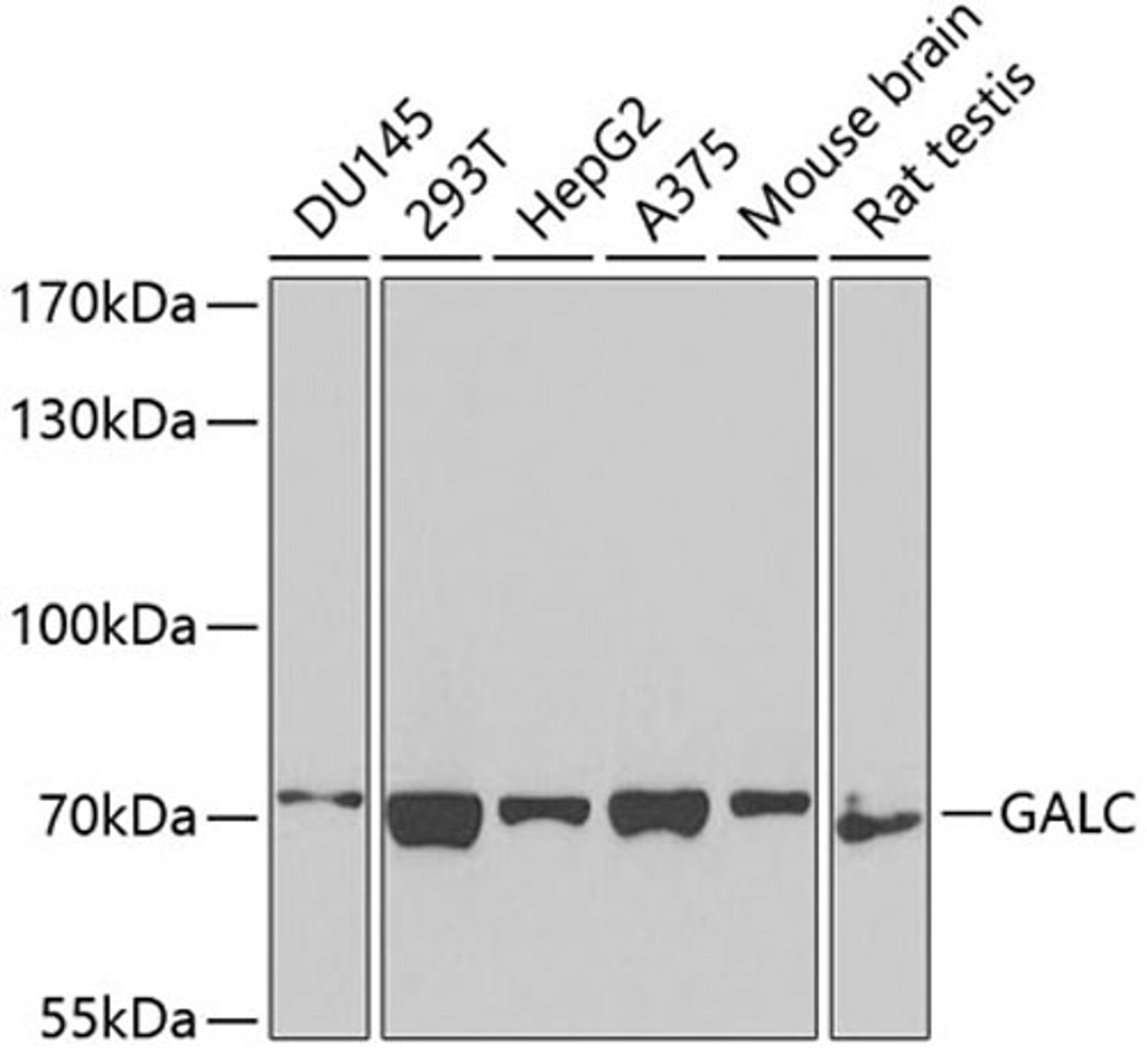 Western blot - GALC antibody (A3873)