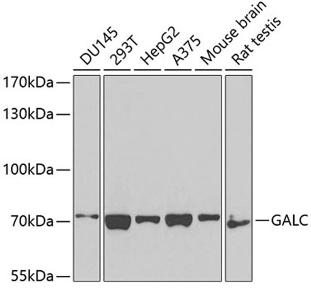 Western blot - GALC antibody (A3873)