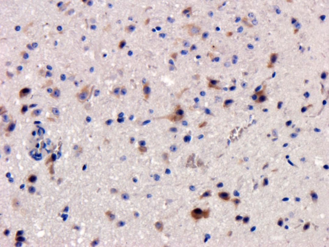 Immunohistochemical staining of mouse brain tissue using anti-Factor VIII (2.5 ug/ml)