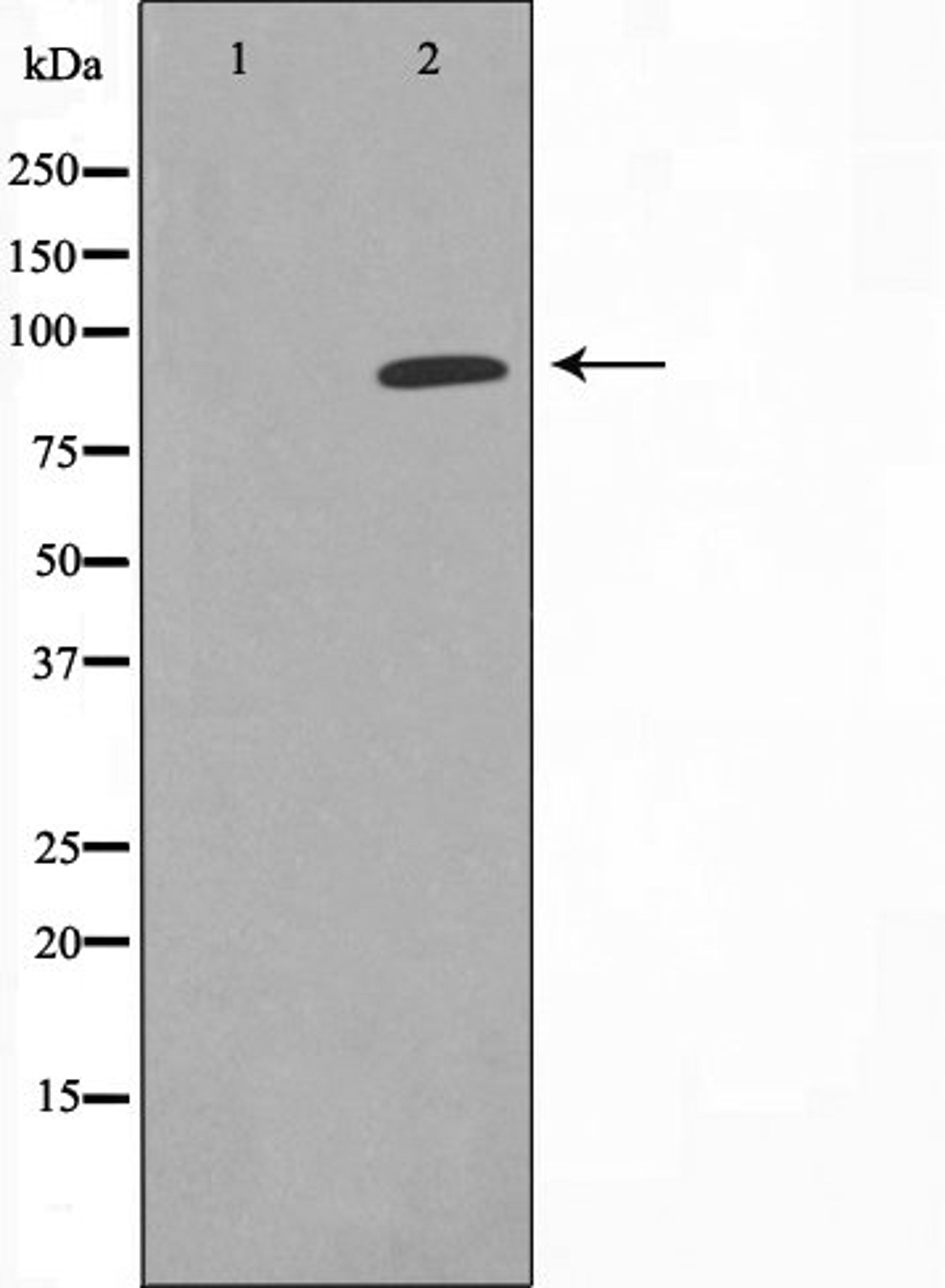 Western blot analysis of COLO cell lysate using CDK11 antibody