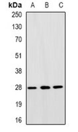 Western blot analysis of SW480 (Lane1), HepG2 (Lane2), A549 (Lane3) whole cell lysates using GTF2F2 antibody