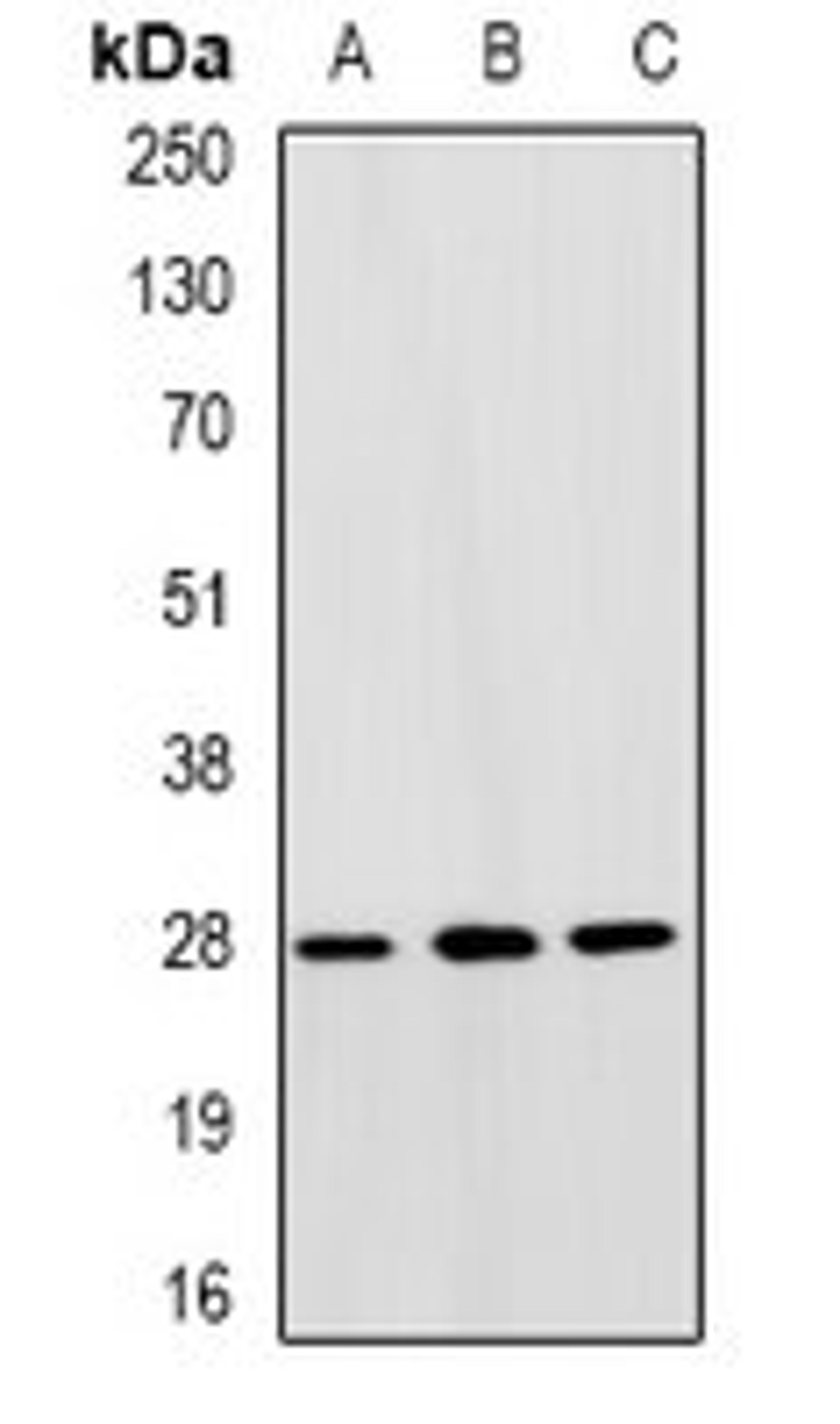 Western blot analysis of SW480 (Lane1), HepG2 (Lane2), A549 (Lane3) whole cell lysates using GTF2F2 antibody