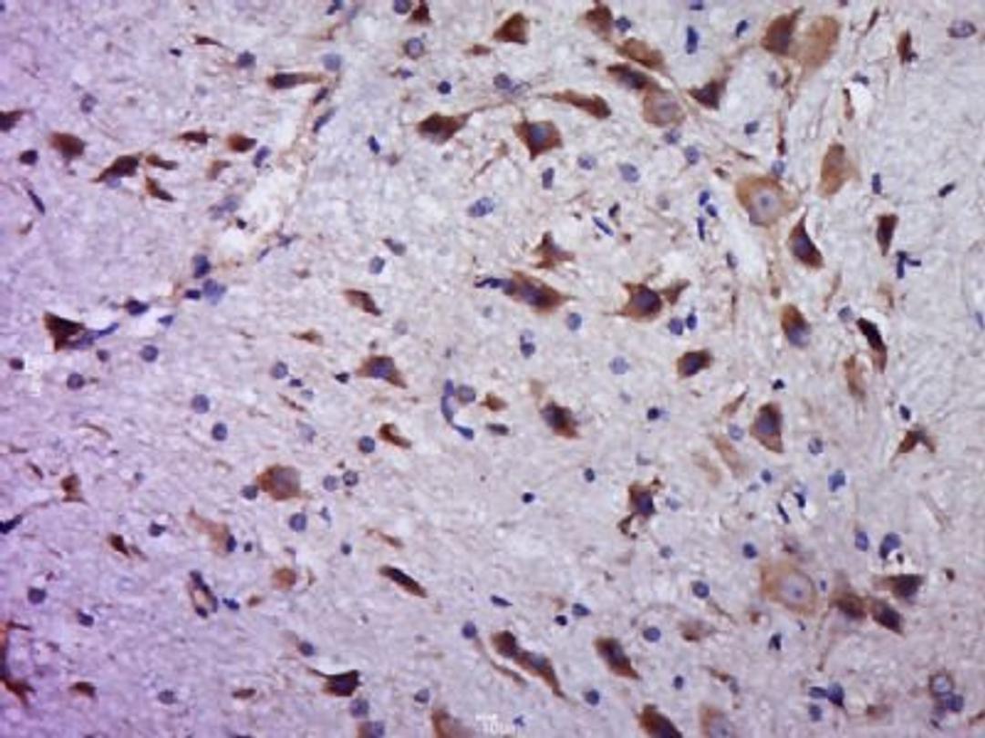 Immunohistochemical staining of rat brain tissue using C20orf94 antibody.