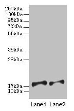 Western blot. All lanes: PFDN5 antibody at 2µg/ml. Lane 1: EC109 whole cell lysate. Lane 2: 293T whole cell lysate. Secondary. Goat polyclonal to rabbit IgG at 1/15000 dilution. Predicted band size: 18, 8, 13 kDa. Observed band size: 18 kDa