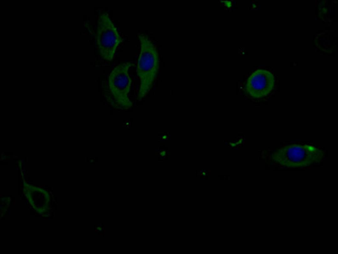 Immunofluorescence staining of A549 cells with CSB-MA007512PA981phHU at 1:100, counter-stained with DAPI. The cells were fixed in 4% formaldehyde and blocked in 10% normal Goat Serum. The cells were incubated with the antibody overnight at 4°C. Nuclear DNA was labeled in blue with DAPI. The secondary antibody was FITC-conjugated AffiniPure Goat Anti-Mouse IgG (H+L).