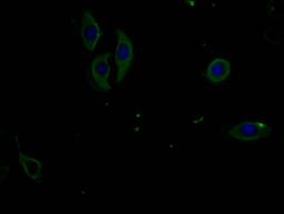 Immunofluorescence staining of A549 cells with CSB-MA007512PA981phHU at 1:100, counter-stained with DAPI. The cells were fixed in 4% formaldehyde and blocked in 10% normal Goat Serum. The cells were incubated with the antibody overnight at 4°C. Nuclear DNA was labeled in blue with DAPI. The secondary antibody was FITC-conjugated AffiniPure Goat Anti-Mouse IgG (H+L).