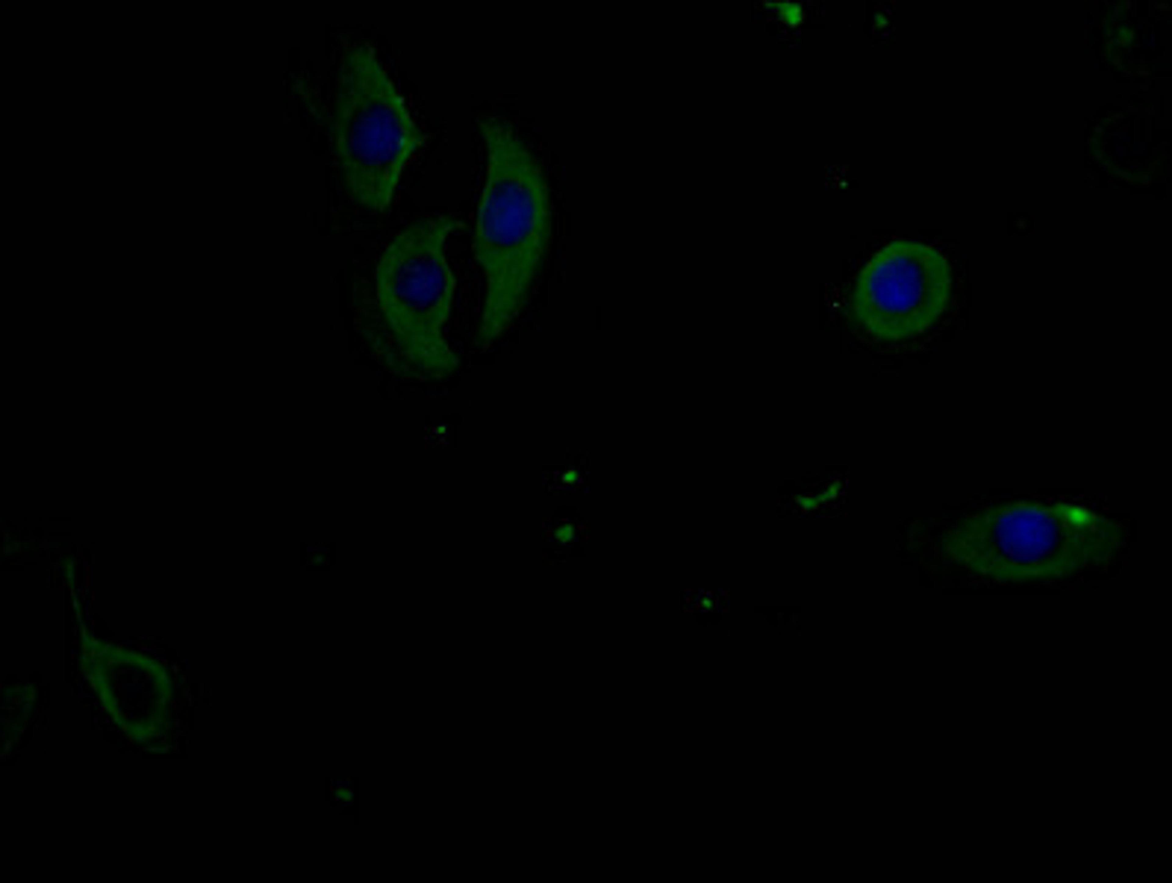 Immunofluorescence staining of A549 cells with CSB-MA007512PA981phHU at 1:100, counter-stained with DAPI. The cells were fixed in 4% formaldehyde and blocked in 10% normal Goat Serum. The cells were incubated with the antibody overnight at 4°C. Nuclear DNA was labeled in blue with DAPI. The secondary antibody was FITC-conjugated AffiniPure Goat Anti-Mouse IgG (H+L).