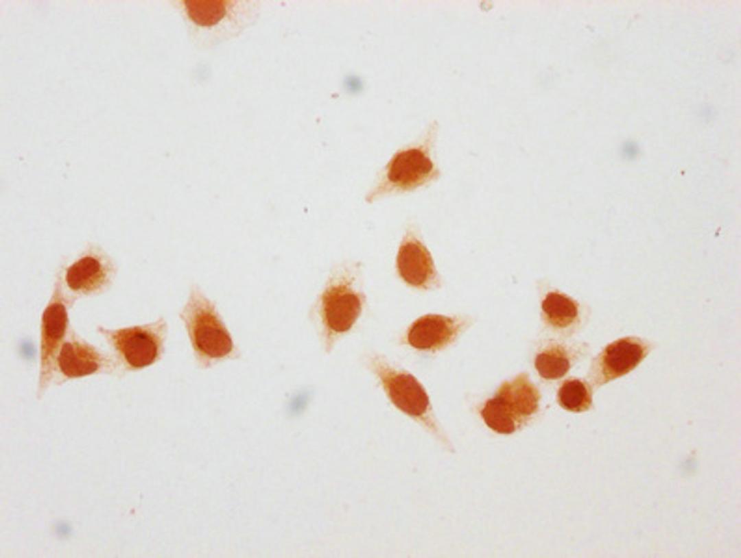 Immunocytochemistry analysis of CSB-PA010378OA116hibHU diluted at 1:50 and staining in Hela cells (treated with 30mM sodium butyrate for 4h) performed on a Leica BondTM system. The cells were fixed in 4% formaldehyde, permeabilized using 0.2% Triton X-100 and blocked with 10% normal goat serum 30min at RT. Then primary antibody (1% BSA) was incubated at 4&deg;C overnight. The primary is detected by a biotinylated secondary antibody and visualized using an HRP conjugated SP system.