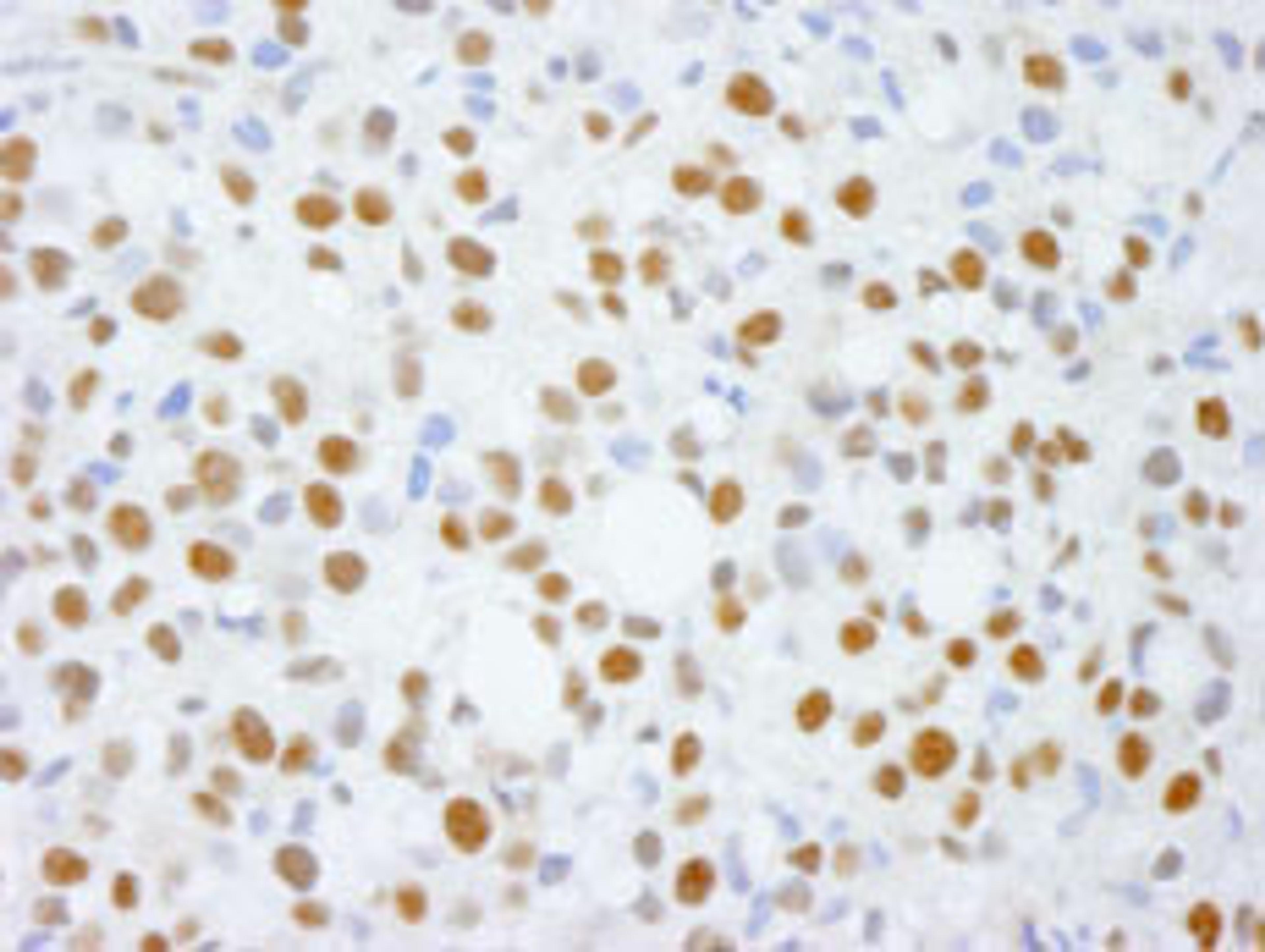 Detection of human ADNP by immunohistochemistry.