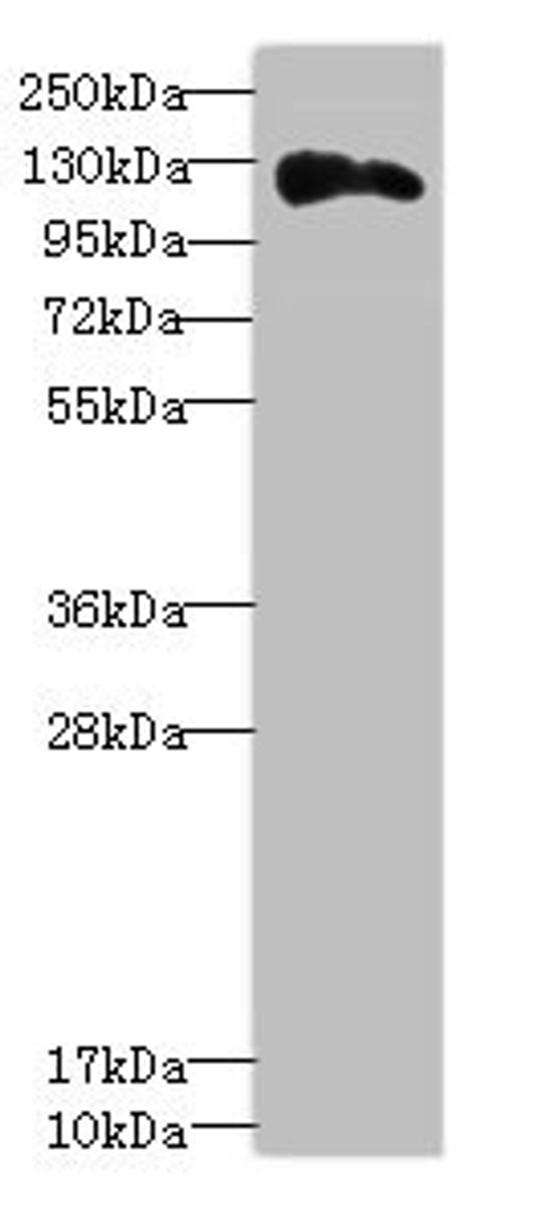Western blot. All lanes: ANLNantibody at 3.43ug/ml + Hela whole cell lysate. Secondary. Goat polyclonal to rabbit IgG at 1/10000 dilution. Predicted band size: 125, 121 kDa. Observed band size: 125 kDa. 