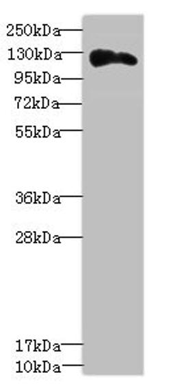 Western blot. All lanes: ANLNantibody at 3.43ug/ml + Hela whole cell lysate. Secondary. Goat polyclonal to rabbit IgG at 1/10000 dilution. Predicted band size: 125, 121 kDa. Observed band size: 125 kDa. 