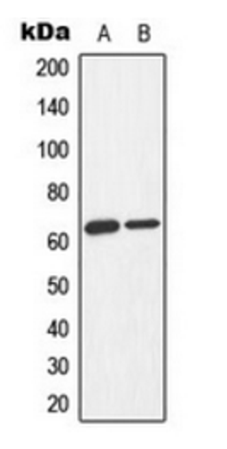 Western blot analysis of Jurkat Adriamycin-treated (Lane 1), K562 Adriamycin-treated (Lane 2) whole cell lysates using AMPK alpha 1/2 (phospho-T183/172) antibody