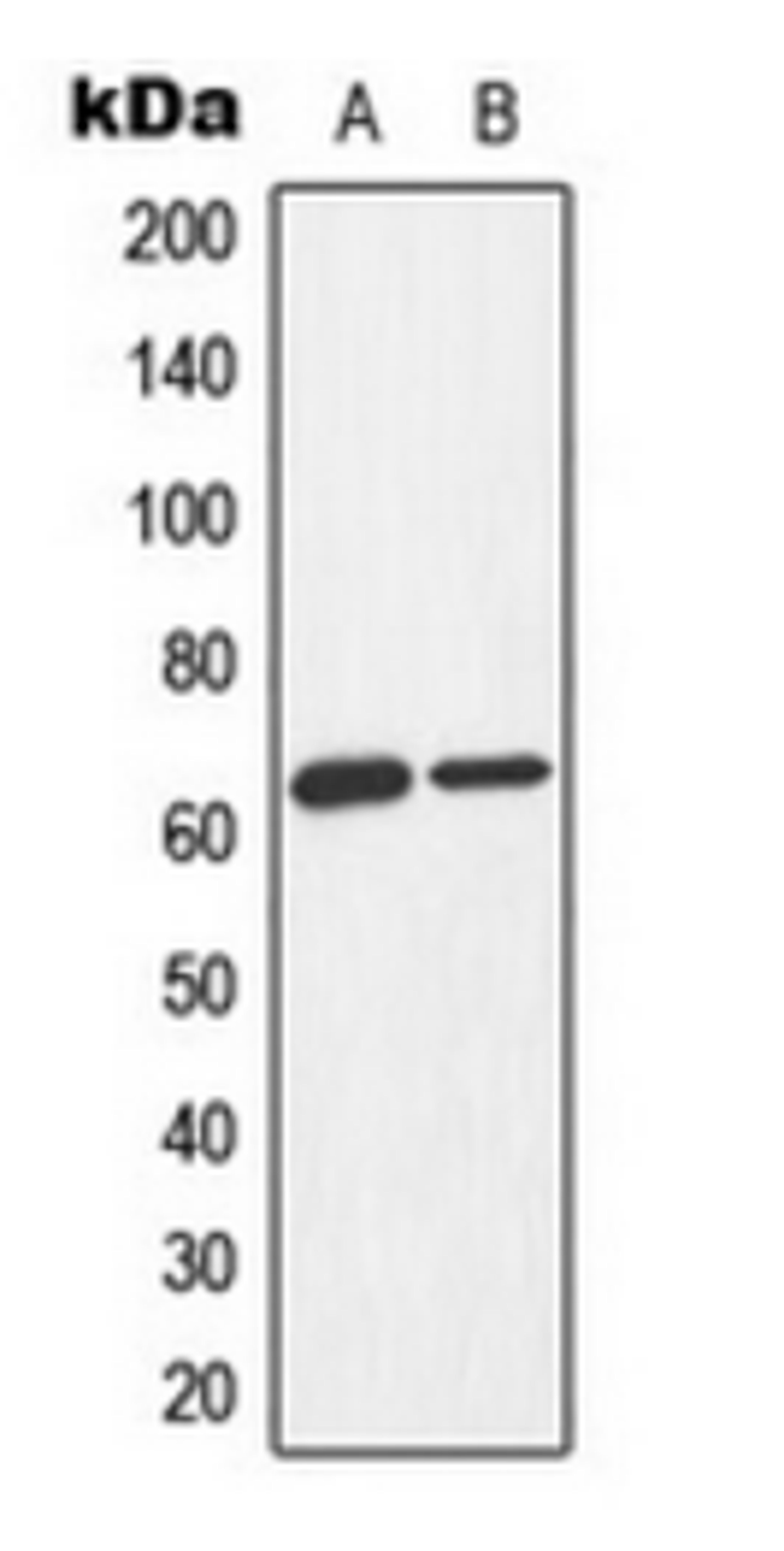 Western blot analysis of Jurkat Adriamycin-treated (Lane 1), K562 Adriamycin-treated (Lane 2) whole cell lysates using AMPK alpha 1/2 (phospho-T183/172) antibody