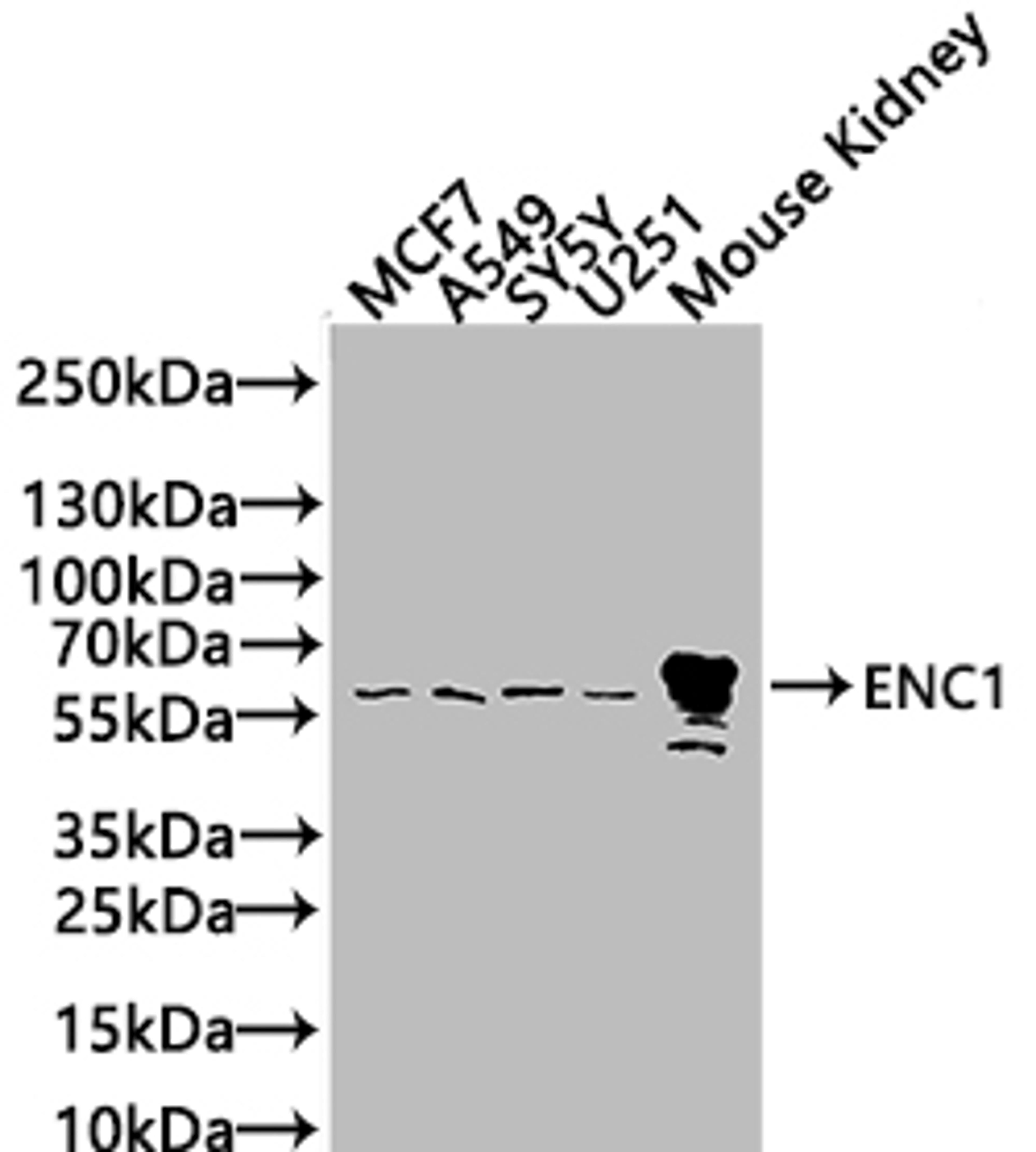 Western blot. All lanes: ENC1 antibody at 5µg/ml. Lane 1: MCF-7 whole cell lysate. Lane 2: HepG2 whole cell lysate. Lane 3: Mouse brain tissue. Lane 4: A549 whole cell lysate. Secondary. Goat polyclonal to rabbit IgG at 1/10000 dilution. Predicted band size: 67, 58 kDa. Observed band size: 67 kDa