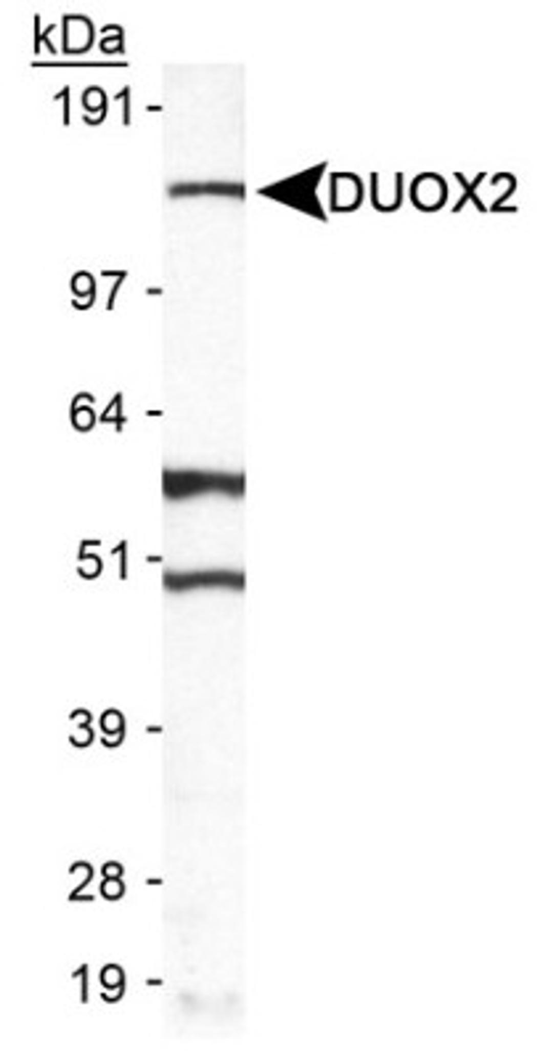 Western Blot: DUOX2 Antibody [NB110-61576] - Detection of DUOX2 in A549 in cell lysate.