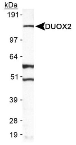 Western Blot: DUOX2 Antibody [NB110-61576] - Detection of DUOX2 in A549 in cell lysate.