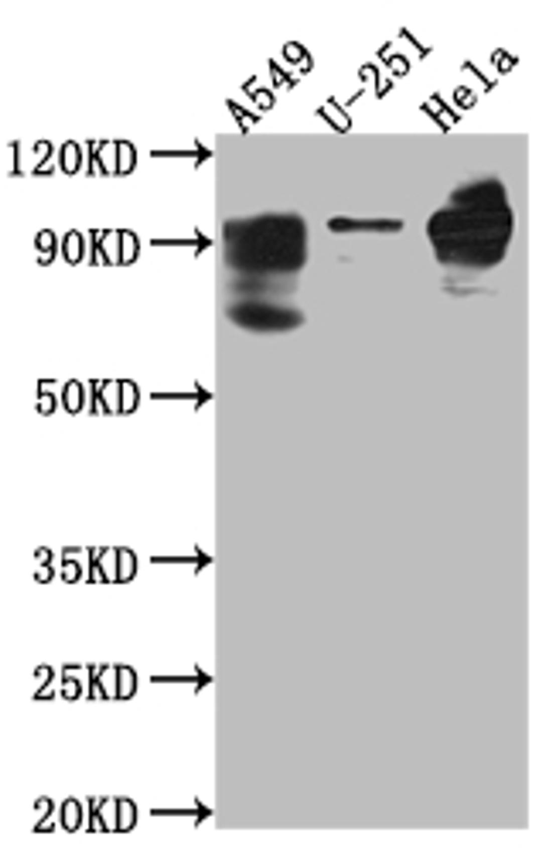Western Blot. Positive WB detected in: THP-1 whole cell lysate. All lanes: PDE4D antibody at 1:1000. Secondary. Goat polyclonal to rabbit IgG at 1/50000 dilution. Predicted band size: 92, 77, 69, 67, 58, 85, 24, 60, 78, 77, 85, 25 kDa. Observed band size: 92 kDa. 