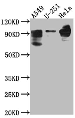 Western Blot. Positive WB detected in: THP-1 whole cell lysate. All lanes: PDE4D antibody at 1:1000. Secondary. Goat polyclonal to rabbit IgG at 1/50000 dilution. Predicted band size: 92, 77, 69, 67, 58, 85, 24, 60, 78, 77, 85, 25 kDa. Observed band size: 92 kDa. 