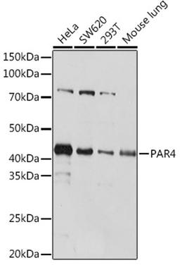 Western blot - PAR4 Rabbit mAb (A4983)