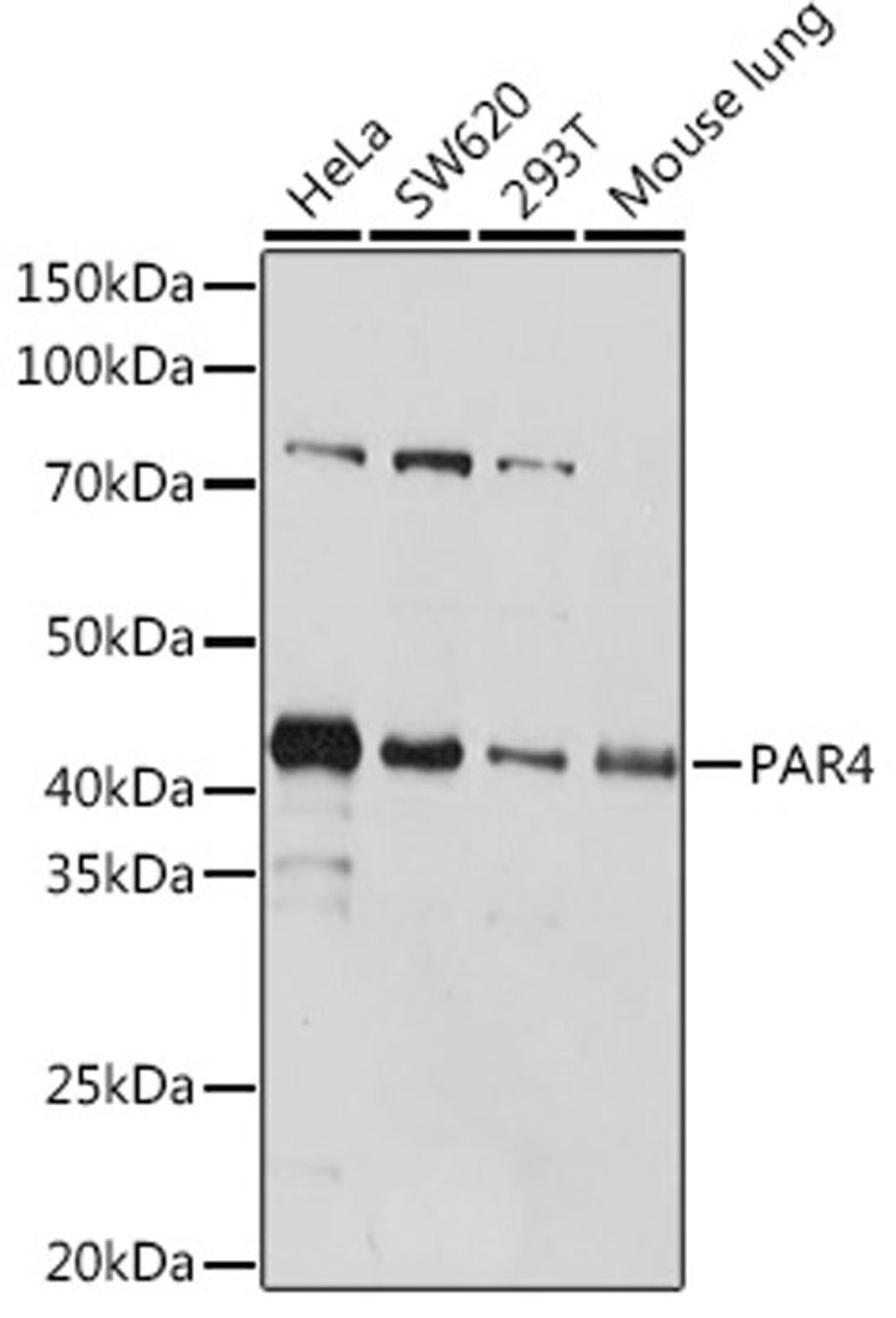 Western blot - PAR4 Rabbit mAb (A4983)