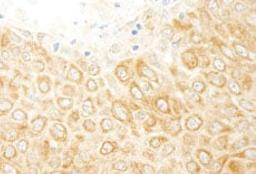 Detection of human ZAK by immunohistochemistry.