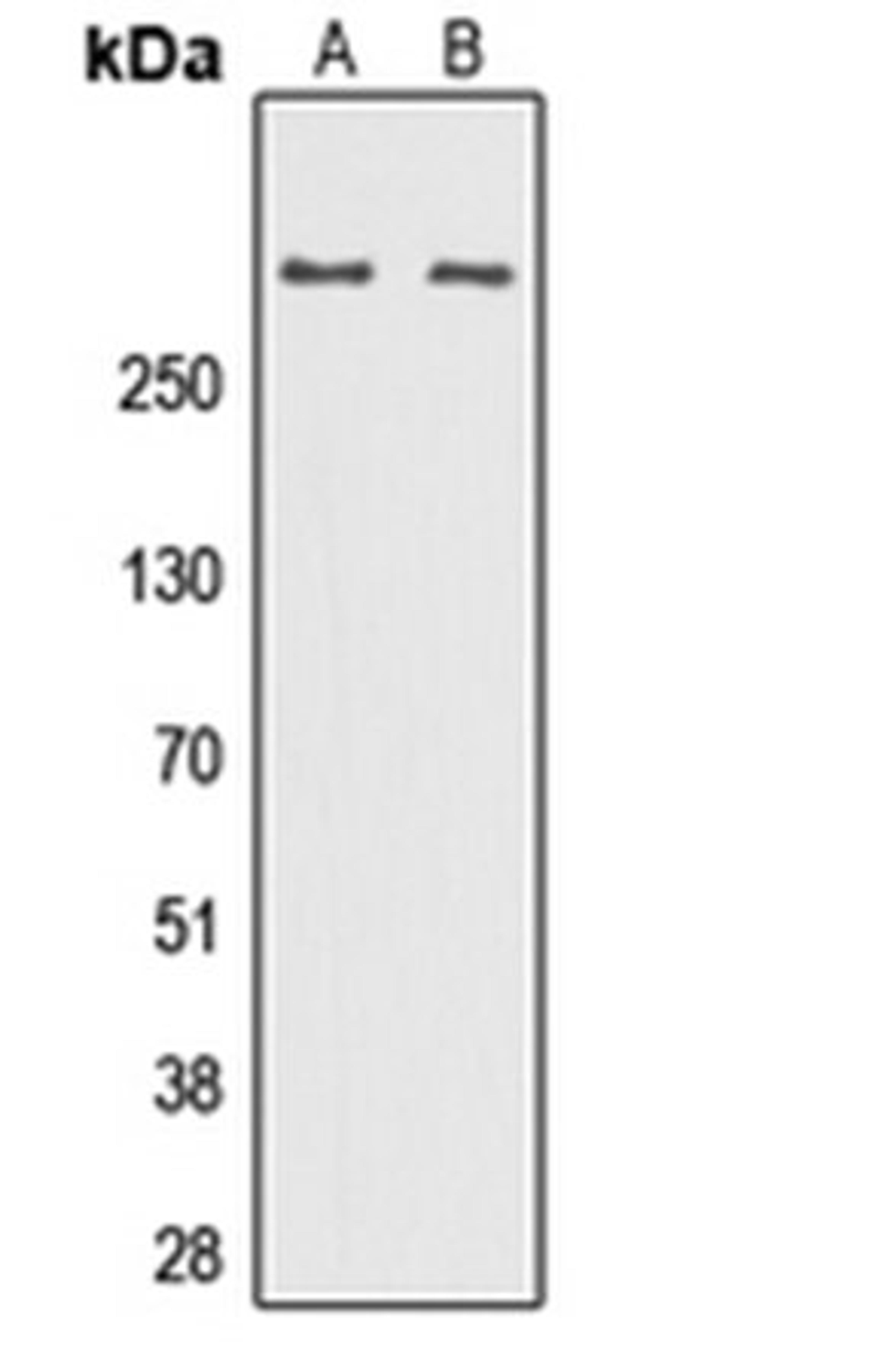 Western blot analysis of K562 (Lane 1), NIH3T3 (Lane 2) whole cell lysates using DNA Polymerase zeta antibody