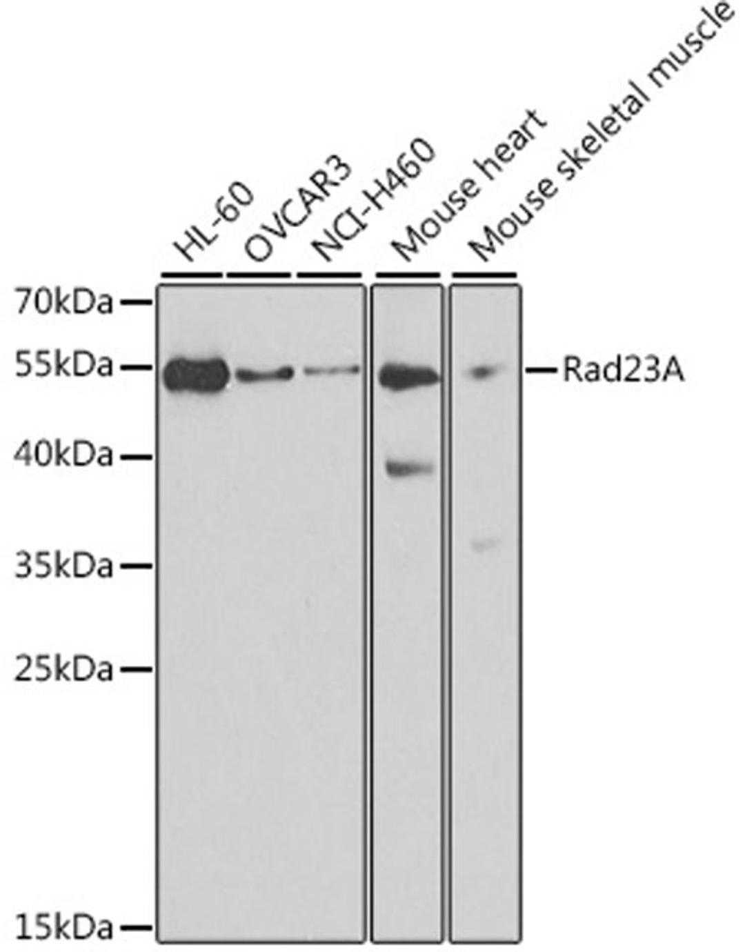 Western blot - Rad23A antibody (A3188)