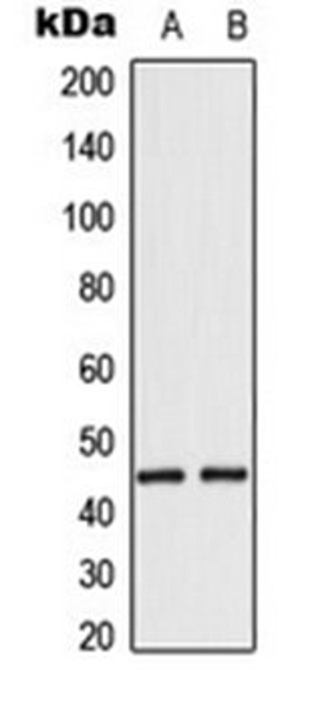 Western blot analysis of HepG2 (Lane 1), HeLa (Lane 2) whole cell lysates using EMP antibody