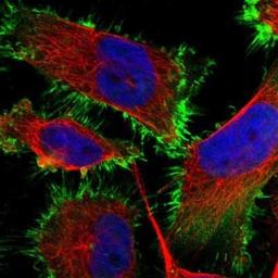 Immunocytochemistry/Immunofluorescence: FCAR/CD89 Antibody [NBP1-88102] - Staining of human cell line U-251MG shows positivity in plasma membrane.