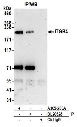 Detection of human ITGB4 by western blot of immunoprecipitates.