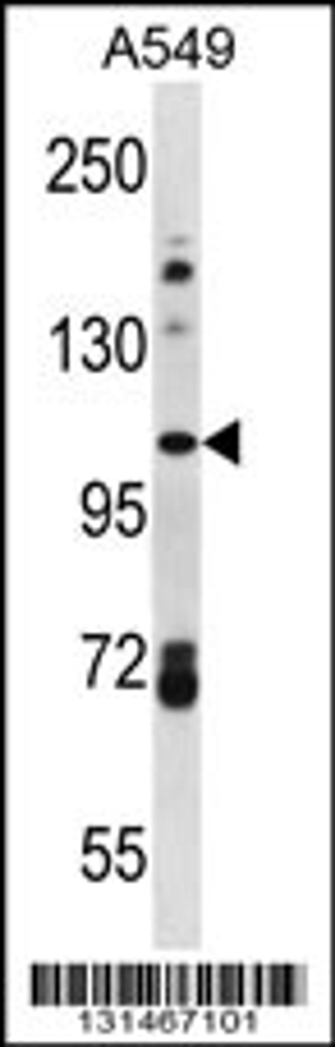 Western blot analysis in A549 cell line lysates (35ug/lane).