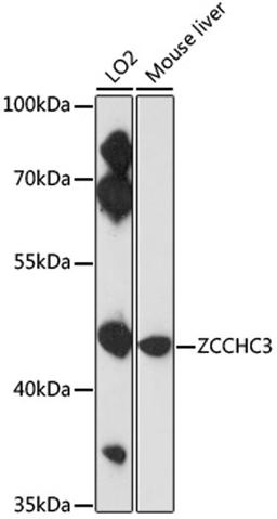 Western blot - ZCCHC3 antibody (A17235)