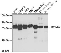 Western blot - RMDN3 antibody (A5820)