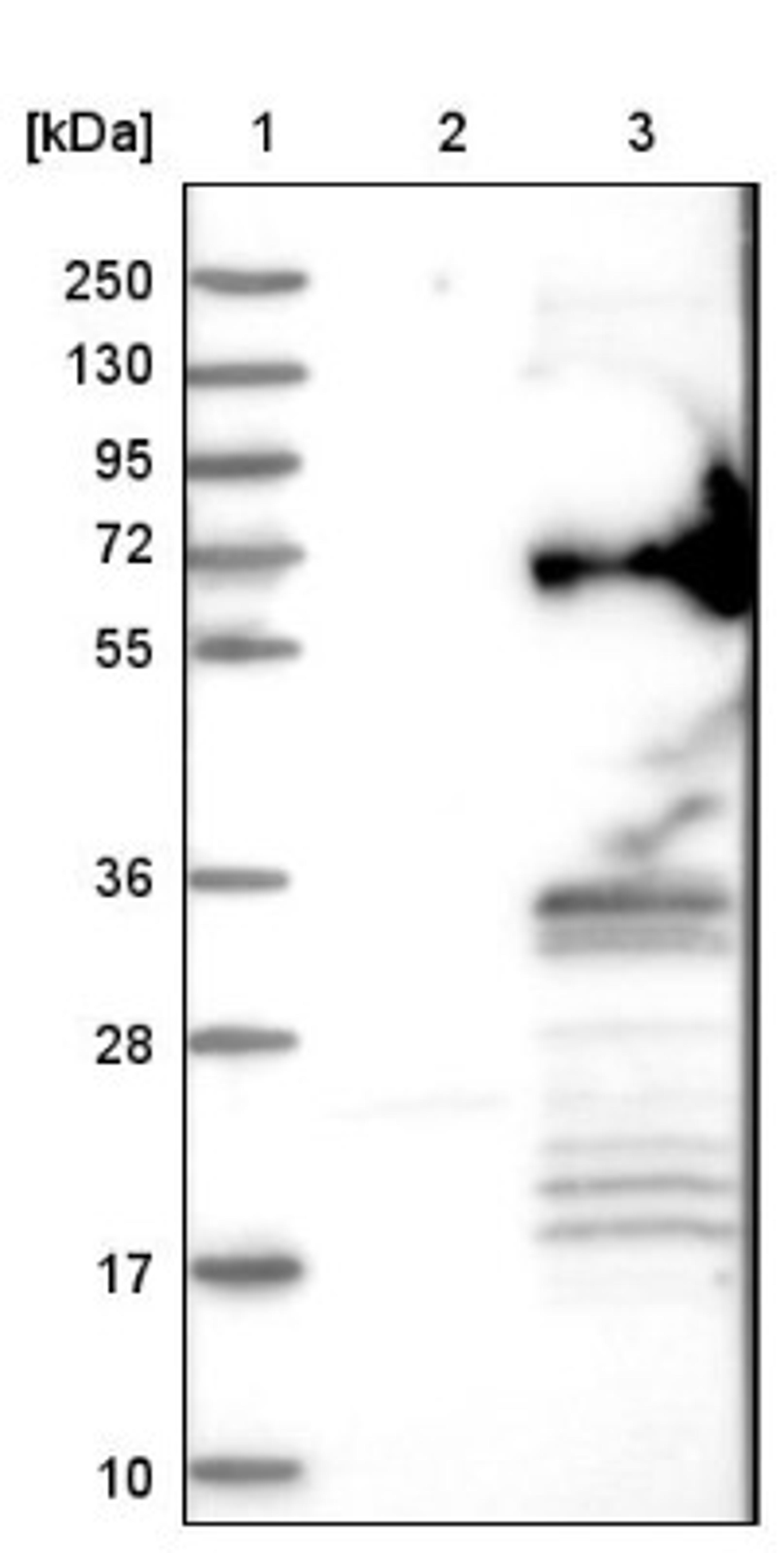 Western Blot: RSRC2 Antibody [NBP1-83787] - Lane 1: Marker [kDa] 250, 130, 95, 72, 55, 36, 28, 17, 10<br/>Lane 2: Negative control (vector only transfected HEK293T lysate)<br/>Lane 3: Over-expression lysate (Co-expressed with a C-terminal myc-DDK tag (~3.1 kDa) in mammalian HEK293T cells, LY411486)