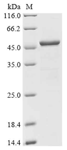 (Tris-Glycine gel) Discontinuous SDS-PAGE (reduced) with 5% enrichment gel and 15% separation gel.