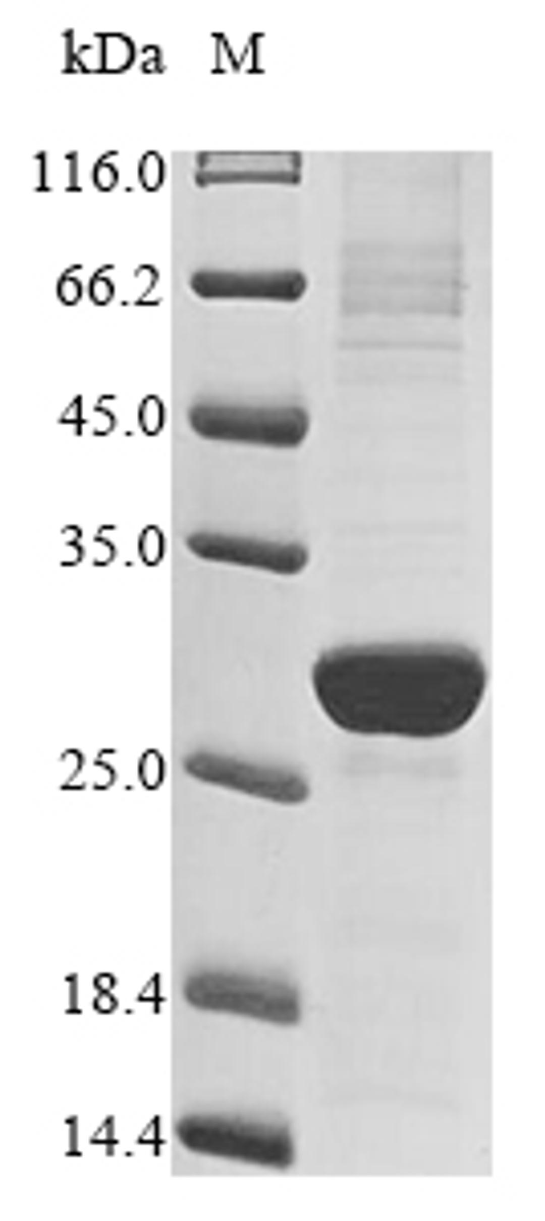 (Tris-Glycine gel) Discontinuous SDS-PAGE (reduced) with 5% enrichment gel and 15% separation gel.