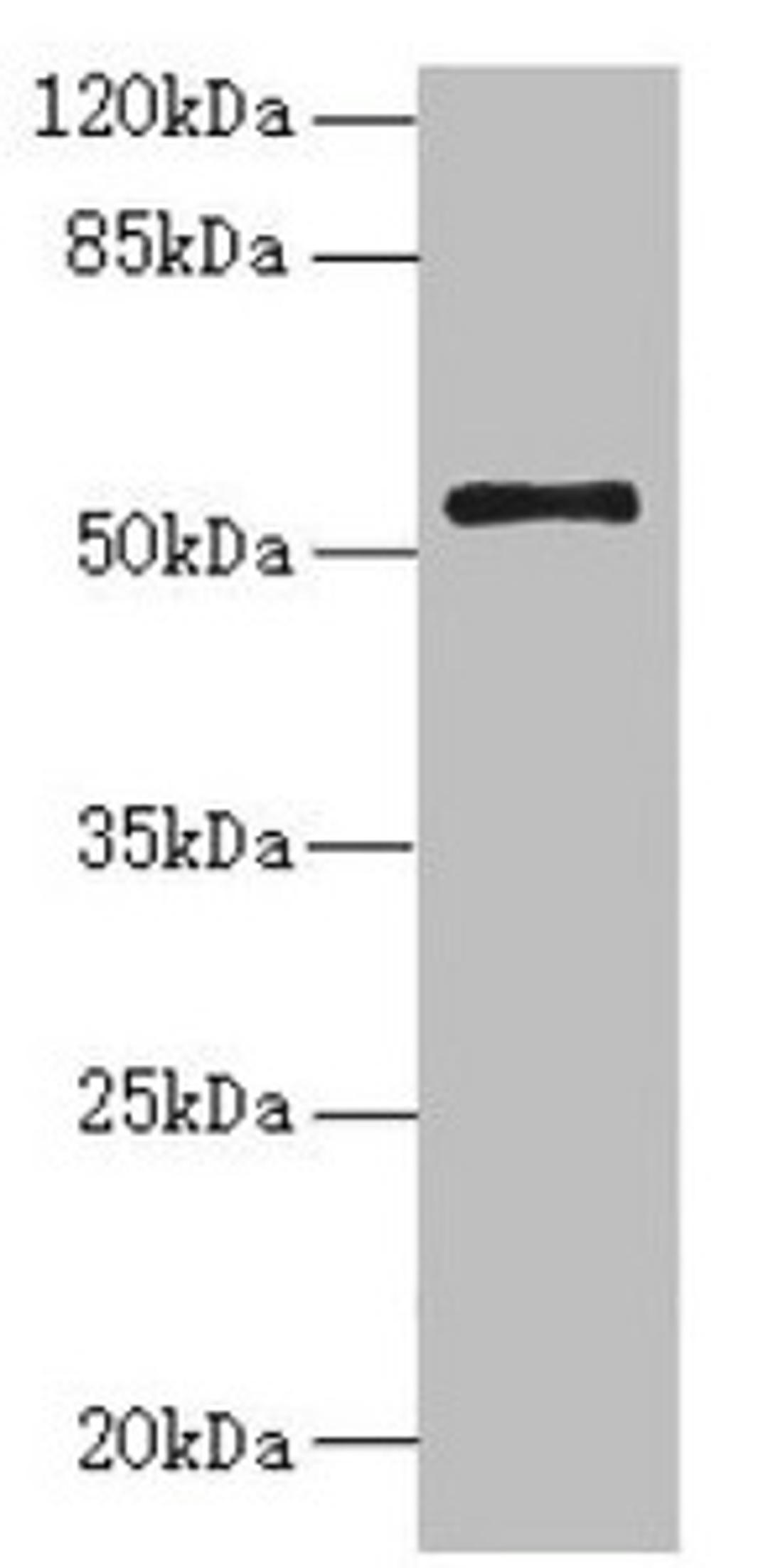 Western blot. All lanes: NLE1 antibody at 1.48µg/ml + PC-3 whole cell lysate. Secondary. Goat polyclonal to rabbit IgG at 1/10000 dilution. Predicted band size: 54, 22 kDa. Observed band size: 54 kDa