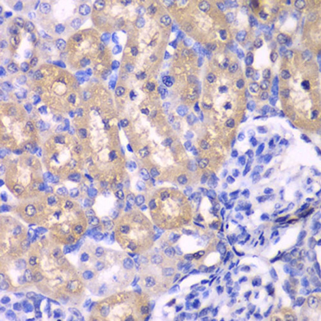 Immunohistochemistry - RPS6KB1 antibody (A0447)