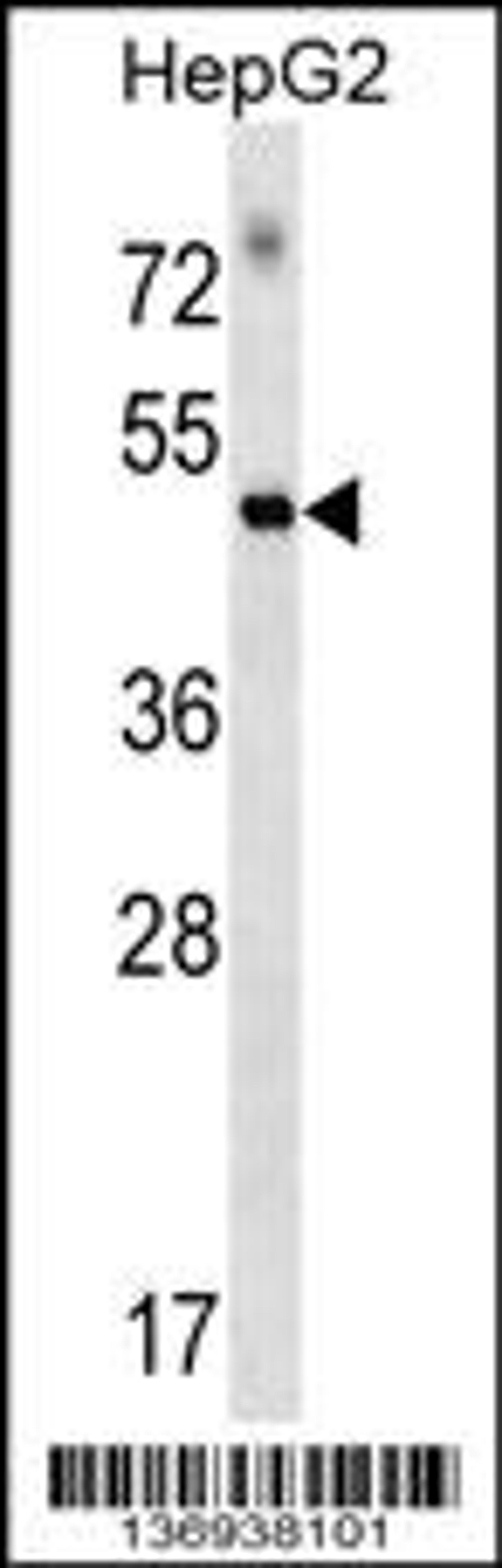 Western blot analysis in HepG2 cell line lysates (35ug/lane).