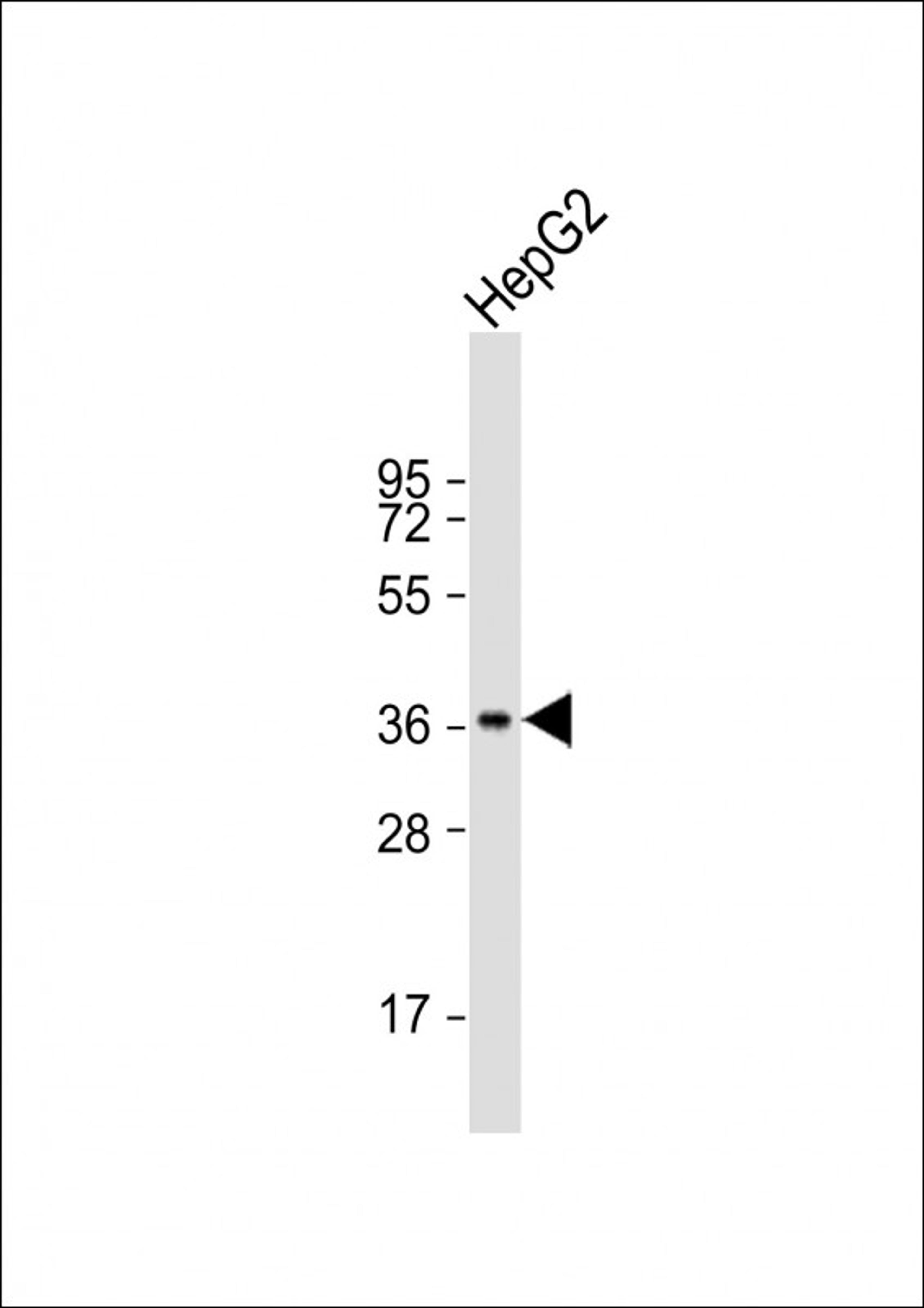 Western Blot at 1:1000 dilution + HepG2 whole cell lysate Lysates/proteins at 20 ug per lane.