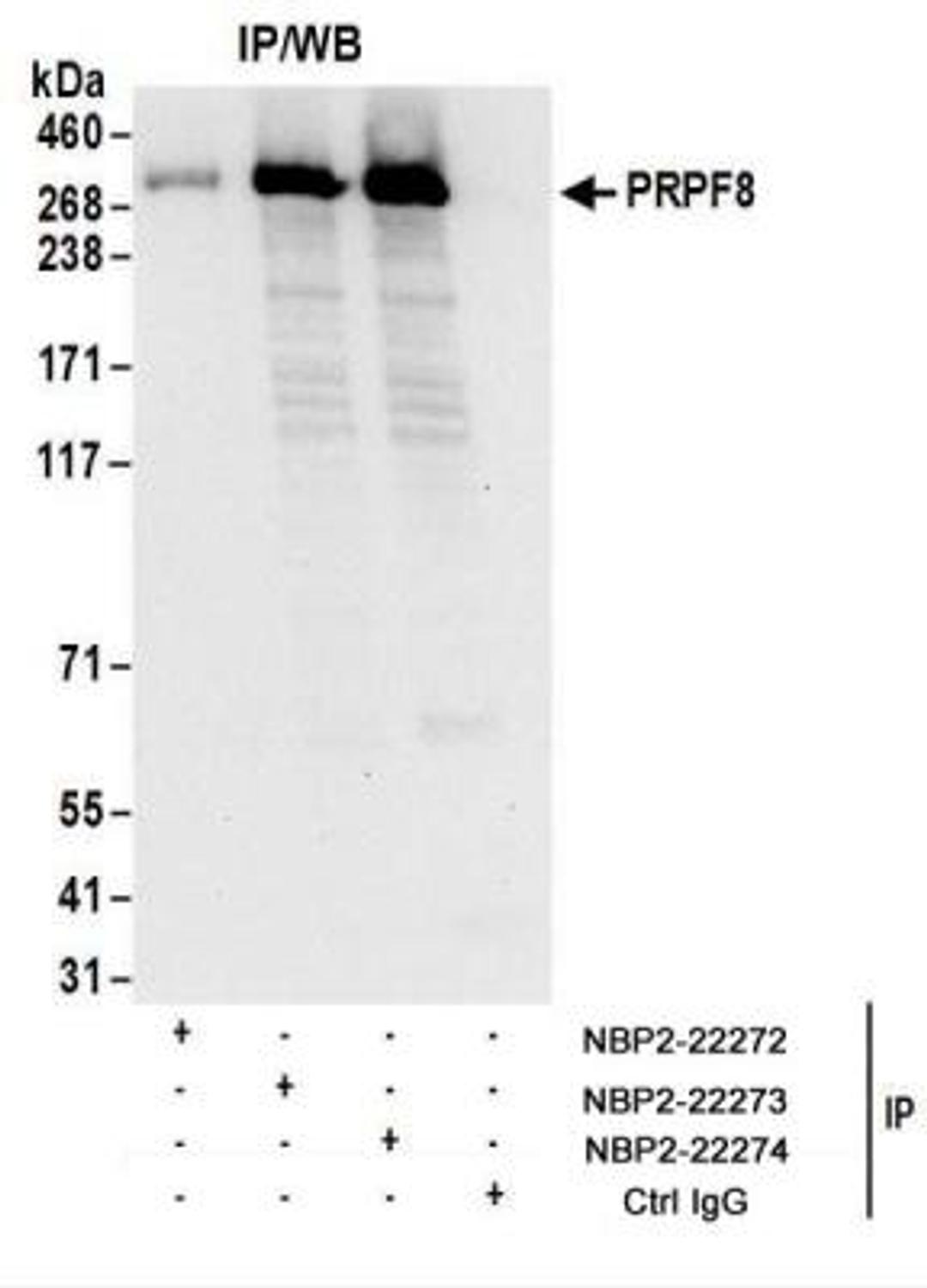 Immunoprecipitation: PRPF8 Antibody [NBP2-22274] - Whole cell lysate (1 mg for IP; 20% of IP loaded) from 293T cells.  Antibodies: Affinity purified rabbit anti-PRPF8 antibody NBP2-22274 used for IP at 6 ug/mg lysate.  PRPF8 was also immunoprecipitated by rabbit anti-PRPF8 antibodies NBP2-22272 and NBP2-22273  For blotting immunoprecipitated PRPF8, NBP2-22274 was used at 1 ug/ml.  Detection: Chemiluminescence with an exposure time of 10 seconds.