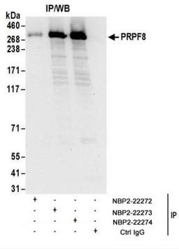 Immunoprecipitation: PRPF8 Antibody [NBP2-22274] - Whole cell lysate (1 mg for IP; 20% of IP loaded) from 293T cells.  Antibodies: Affinity purified rabbit anti-PRPF8 antibody NBP2-22274 used for IP at 6 ug/mg lysate.  PRPF8 was also immunoprecipitated by rabbit anti-PRPF8 antibodies NBP2-22272 and NBP2-22273  For blotting immunoprecipitated PRPF8, NBP2-22274 was used at 1 ug/ml.  Detection: Chemiluminescence with an exposure time of 10 seconds.