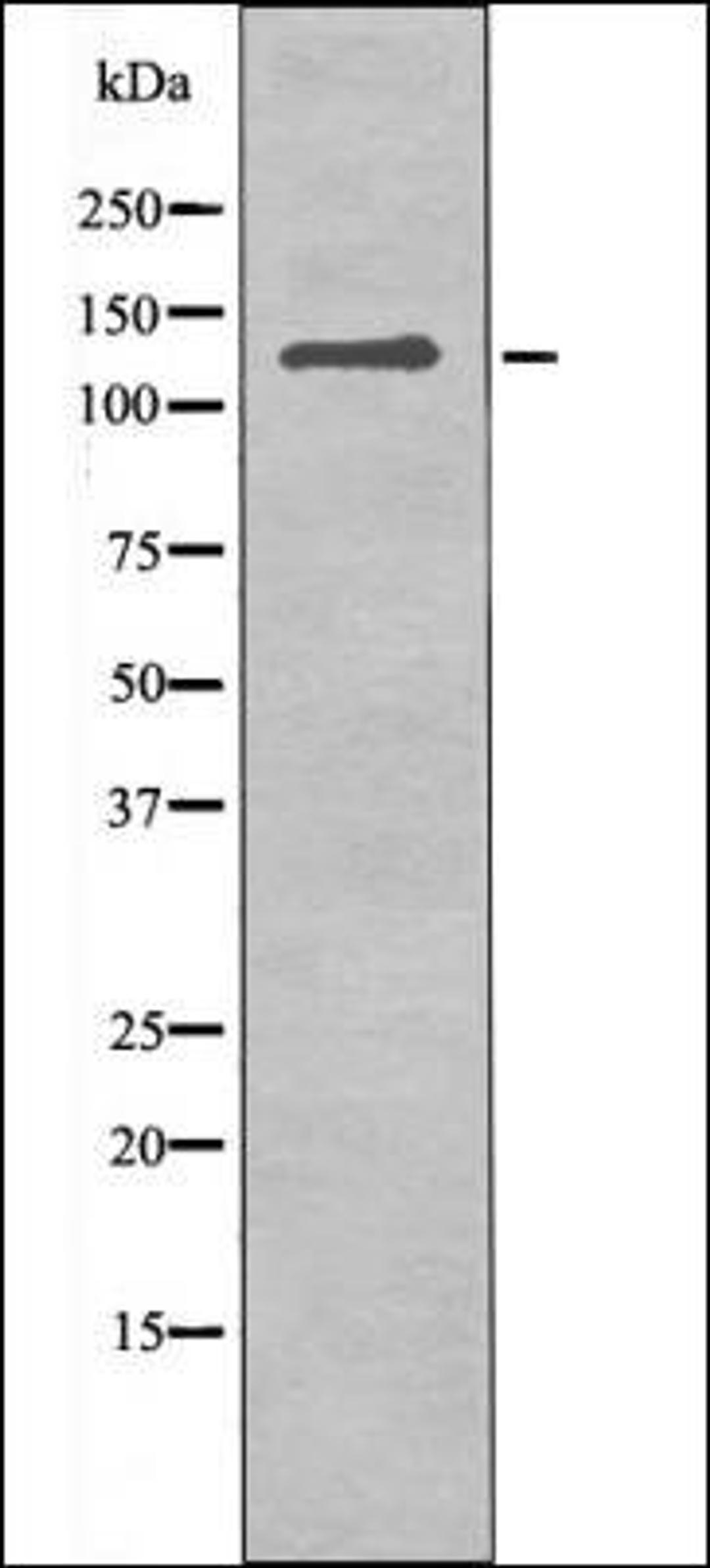 Western blot analysis of UV treated COS7 whole cell lysates using JAK3 -Phospho-Tyr981- antibody