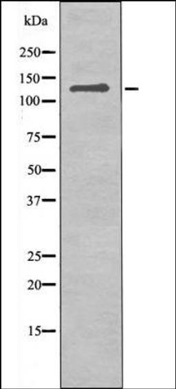 Western blot analysis of UV treated COS7 whole cell lysates using JAK3 -Phospho-Tyr981- antibody