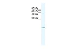 Antibody used in WB on Human HepG2 at 1.25 ug/ml.