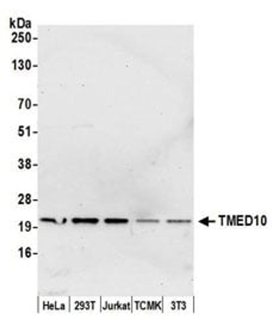 Detection of human and mouse TMED10 by western blot.