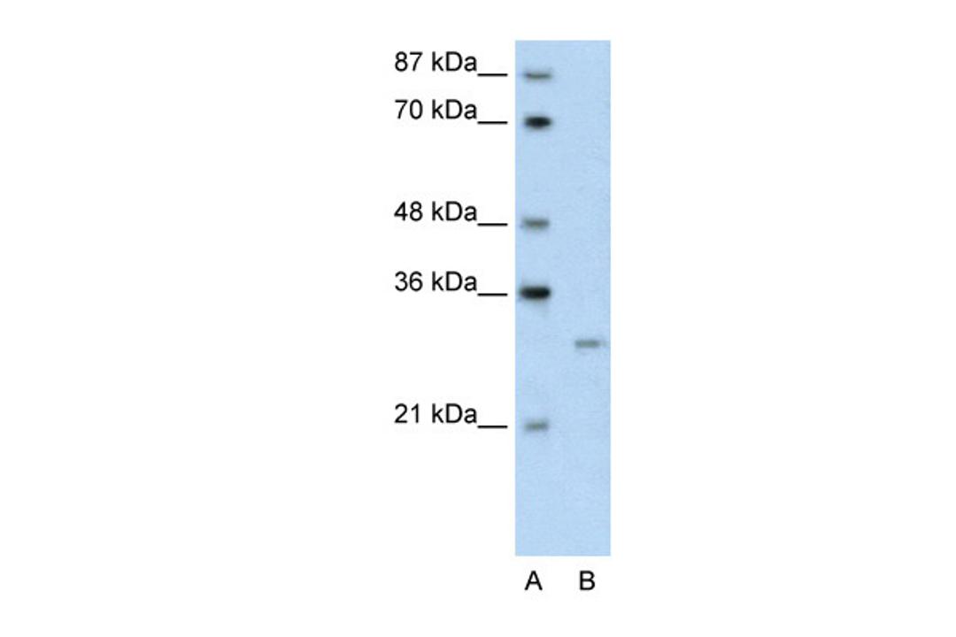 Antibody used in WB on Transfected 293T at 0.2-1 ug/ml.