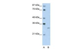 Antibody used in WB on Transfected 293T at 0.2-1 ug/ml.